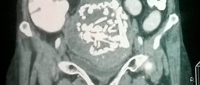 Image - Le Point titre : « États-Unis : le casse-tête des mères porteuses qu&rsquo;on veut faire avorter »